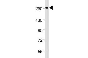 Western blot testing of Nestin antibody at 1:2000 dilution + HeLa lysate (Nestin antibody  (AA 1389-1416))