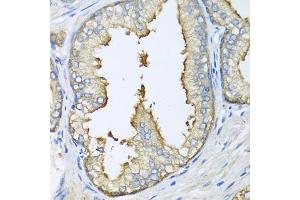 Immunohistochemistry of paraffin-embedded human prostate using ATG5 antibody.