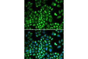 Immunofluorescence analysis of A549 cells using HAX1 antibody. (HAX1 antibody)