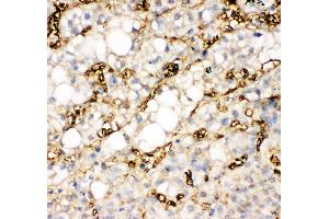 Anti-liver FABP antibody,  IHC(P) IHC(P): Human Liver Cancer Tissue (FABP1 antibody  (N-Term))