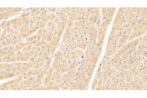 Detection of NT-ProBNP in Human Cardiac Muscle Tissue using Monoclonal Antibody to N-Terminal Pro-Brain Natriuretic Peptide (NT-ProBNP) (NT-ProBNP antibody)