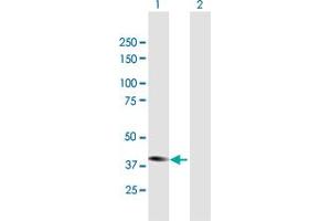 Western Blot analysis of STYK1 expression in transfected 293T cell line by STYK1 MaxPab polyclonal antibody. (STYK1 antibody  (AA 1-422))