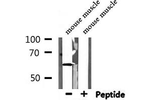 Western blot analysis of extracts from mouse muscle, using KCNQ1 Antibody. (KCNQ1 antibody  (C-Term))