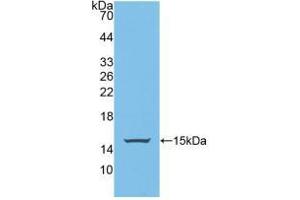Figure. (PUMA antibody  (AA 76-170))
