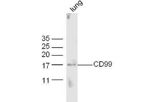 Mouse lung lysates probed with Anti-CD99 Polyclonal Antibody, Unconjugated  at 1:5000 90min in 37˚C. (CD99 antibody  (AA 45-150))