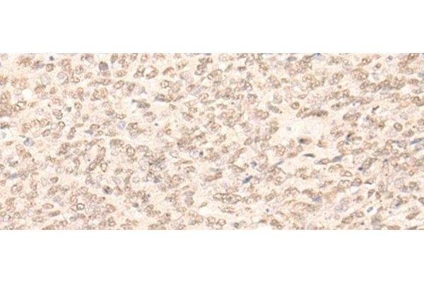 RBM17 antibody