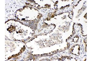 Immunohistochemistry (IHC) image for anti-RAN Binding Protein 1 (RANBP1) (AA 2-201) antibody (ABIN5518868)