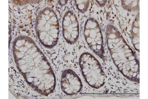 Immunoperoxidase of monoclonal antibody to USP48 on formalin-fixed paraffin-embedded human colon. (USP48 antibody  (AA 110-219))