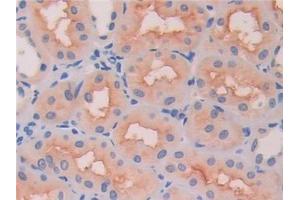 Immunohistochemistry (IHC) image for anti-Hexosaminidase B (Beta Polypeptide) (HEXB) (AA 122-311) antibody (ABIN7438553)
