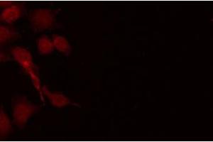 ABIN6266960 staining HeLa by IF/ICC. (IRF4 antibody  (C-Term))