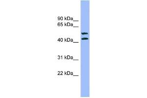 WB Suggested Anti-TMPRSS3 Antibody Titration: 0. (TMPRSS3 antibody  (N-Term))