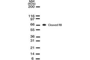 Image no. 1 for anti-Retinoblastoma Protein (Rb Protein) (Cleavage Site) antibody (ABIN207915) (Retinoblastoma Protein (Rb) antibody  (Cleavage Site))