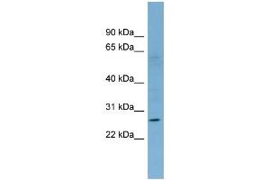 WB Suggested Anti-KLRF1 Antibody Titration:  0. (KLRF1 antibody  (Middle Region))