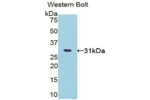 Detection of Recombinant PRDM1, Mouse using Polyclonal Antibody to PR Domain Containing Protein 1 (PRDM1) (PRDM1 antibody  (AA 576-813))