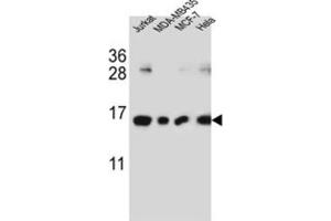 Western Blotting (WB) image for anti-H2A Histone Family, Member J (H2AFJ) antibody (ABIN3002385)