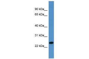 WB Suggested Anti-TP53INP1 Antibody Titration: 0.