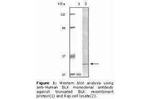 Image no. 2 for anti-B Lymphoid Tyrosine Kinase (BLK) antibody (ABIN232110) (BLK antibody)