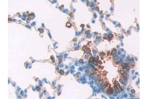 Detection of SPA2 in Rat Lung Tissue using Polyclonal Antibody to Surfactant Associated Protein A2 (SPA2) (SFTPA2 antibody  (AA 21-248))