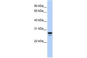 WB Suggested Anti-HMGB2 Antibody Titration: 0.