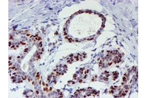 Immunohistochemical staining of paraffin-embedded Human breast tissue using anti-WWTR1 mouse monoclonal antibody. (WWTR1 antibody)