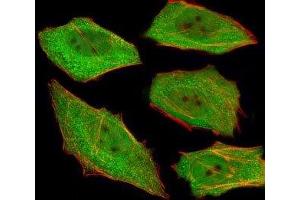 Fluorescent image of U251 cells stained with VCP antibody at 1:25.