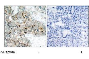 Image no. 1 for anti-Integrin beta 3 (ITGB3) (pTyr773) antibody (ABIN196720) (Integrin beta 3 antibody  (pTyr773))