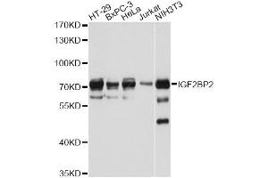 Western blot analysis of extracts of various cell lines, using IGF2BP2 antibody. (IGF2BP2 antibody)