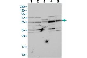 Western blot analysis of Lane 1: RT-4, Lane 2: U-251 MG, Lane 3: Human Plasma, Lane 4: Liver, Lane 5: Tonsil with NARFL polyclonal antibody  at 1:250-1:500 dilution.