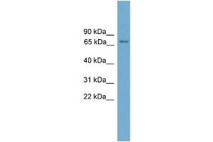 WB Suggested Anti-PRKCH AntibodyTitration: 1. (PKC eta antibody  (N-Term))