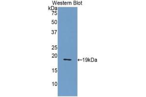 Detection of recombinant NUCB2 using Polyclonal Antibody to Nucleobindin 2 (NUCB2) (NUCB2 antibody  (AA 108-246))