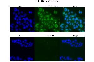 Sample Type :  MCF7   Primary Antibody Dilution:  4 ug/ml   Secondary Antibody :  Anti-rabbit Alexa 546   Secondary Antibody Dilution:  2 ug/ml   Gene Name :  PPP1R10 (PPP1R10 antibody  (N-Term))