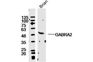 Mouse brain lysates probed with Rabbit Anti-GABRA2/GABA A Receptor alpha 2 Polyclonal Antibody, Unconjugated  ) at 1:300 overnight at 4˚C. (GABRA2 antibody  (AA 185-280))