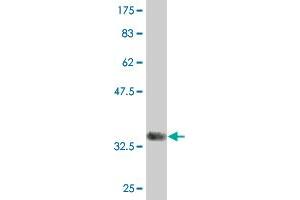 Western Blot detection against Immunogen (33. (ITGB1BP2 antibody  (AA 246-319))