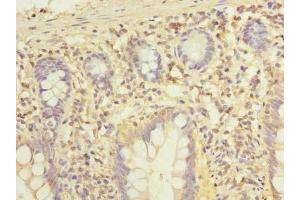 Immunohistochemistry of paraffin-embedded human small intestine tissue using ABIN7143395 at dilution of 1:100 (ELTD1 antibody  (AA 85-299))