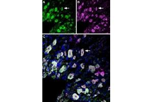 Immunohistochemistry (IHC) image for anti-Nerve Growth Factor Receptor (NGFR) (AA 188-203), (Extracellular) antibody (Atto 488) (ABIN7043345)