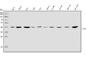 Western blot analysis of SOX18 using anti-SOX18 antibody (ABIN7602205).