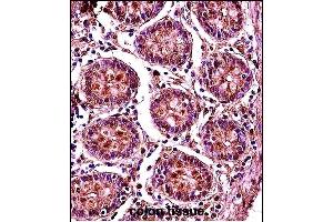 SMC1B Antibody (Center) (ABIN657773 and ABIN2846748) immunohistochemistry analysis in formalin fixed and paraffin embedded human colon tissue followed by peroxidase conjugation of the secondary antibody and DAB staining. (SMC1B antibody  (AA 737-765))