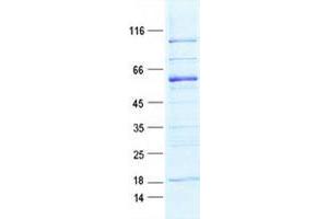 Western Blotting (WB) image for Myozenin 2 (MYOZ2) protein (GST tag,His tag) (ABIN5505729)