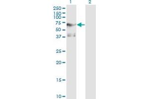 Western Blot analysis of PLK1 expression in transfected 293T cell line by PLK1 monoclonal antibody (M01), clone 2G12. (PLK1 antibody  (AA 1-603))