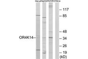Western blot analysis of extracts from HeLa/HepG2/HuvEc cells, using OR4K14 Antibody. (OR4K14 antibody  (AA 261-310))
