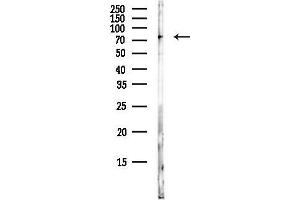 anti-Transglutaminase 2 (C Polypeptide, Protein-Glutamine-gamma-Glutamyltransferase) (TGM2) (N-Term) antibody