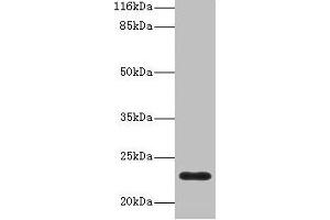 Western blot All lanes: C8G antibody at 2 μg/mL + Human serum Secondary Goat polyclonal to rabbit IgG at 1/10000 dilution Predicted band size: 23 kDa Observed band size: 23 kDa (C8G antibody  (AA 21-202))