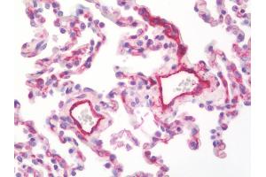 Anti-MCAM / CD146 antibody IHC staining of human lung. (MCAM antibody  (AA 84-189))