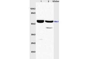 Lane 1: rat liver lysates Lane 2: rat brain lysates probed with Anti phospho-AKT1/2/3 (Tyr315/316/312) Polyclonal Antibody, Unconjugated (ABIN756217) at 1:200 in 4 °C. (AKT 1/2/3 antibody  (pTyr312, pTyr315, pTyr316))
