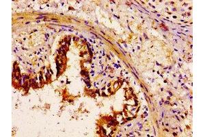 IHC image of ABIN7160568 diluted at 1:100 and staining in paraffin-embedded human lung tissue performed on a Leica BondTM system. (Myosin antibody  (AA 1058-1195))