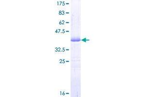 PDE3A Protein (AA 533-640) (GST tag)