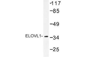 Image no. 1 for anti-ELOVL Fatty Acid Elongase 1 (ELOVL1) antibody (ABIN317834)