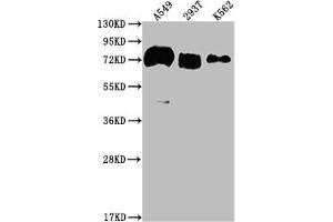 Western Blot Positive WB detected in: A549 whole cell lysate, 293T whole cell lysate, K562 whole cell lysate All lanes: CD55 antibody at 1:2000 Secondary Goat polyclonal to rabbit IgG at 1/50000 dilution Predicted band size: 42, 49, 40, 57, 60 kDa Observed band size: 70 kDa (Recombinant CD55 antibody)