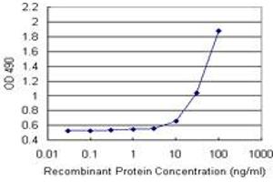 Sandwich ELISA detection sensitivity ranging from 10 ng/mL to 100 ng/mL. (TAGLN (Human) Matched Antibody Pair)