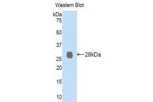 Western Blotting (WB) image for anti-Lysyl Oxidase-Like 2 (LOXL2) (AA 544-751) antibody (ABIN1859686) (LOXL2 antibody  (AA 544-751))